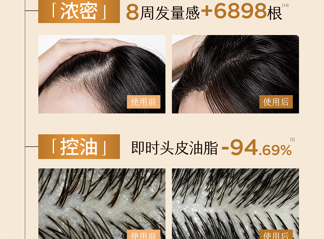 防脱洗发水详情页 09